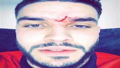 طبيب الأهلي: أزارو جاهز لمباراة السوبر