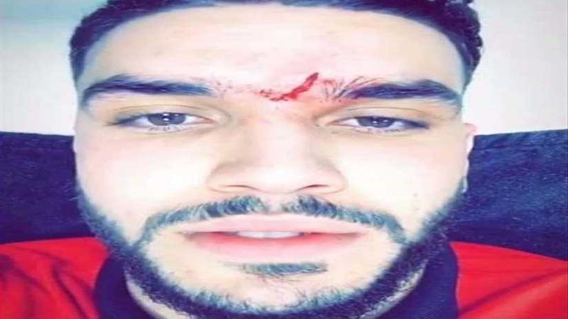 طبيب الأهلي: أزارو