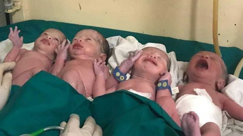 ولادة نادرة لـ4 توائم