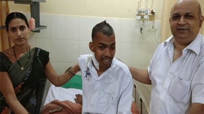 بالصور..أطباء يزيلون أكبر ورم دماغي في العالم