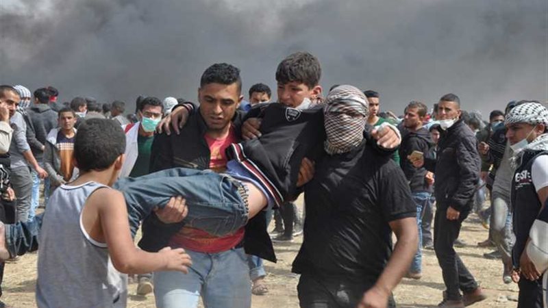 سقوط 174 مصابًا واستشهاد