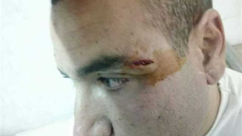 الحبس 4 أيام لأمين