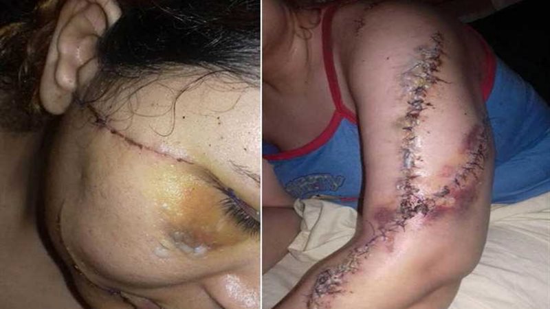 طلبت الخلع فشوهها