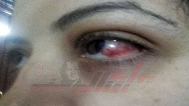 الاعتداء على سيدة