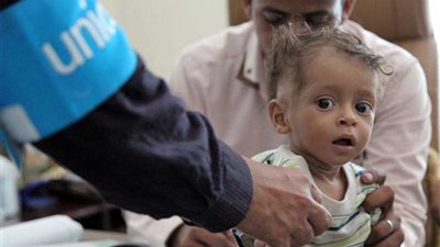 يونيسيف: 11 مليون طفل باليمن يحتاجون لمساعدات