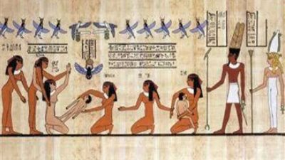 أول عملية لإزالة المياه البيضاء من العيون عمرها 2618 عامًا