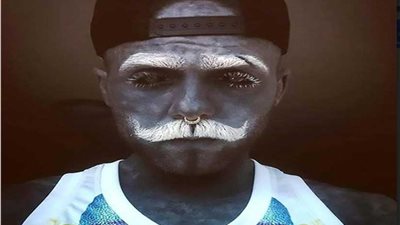 رجل مغطى بـ 90٪ بــ