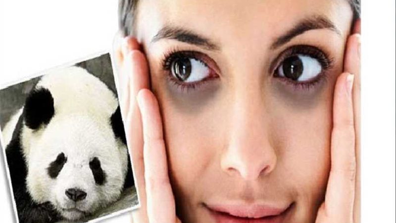 أفضل وصفات علاج الهالات