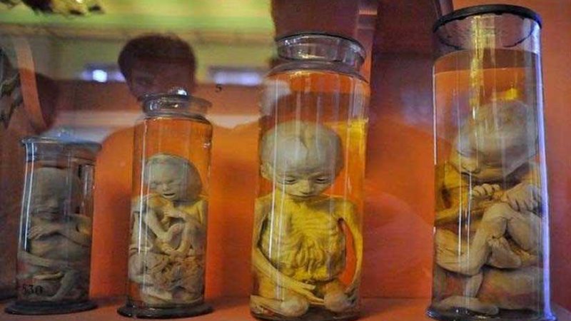 السيريراج.. متحف