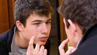 حسب موقعها على الوجه ..حب الشباب يمكن أن يكون مميتا!