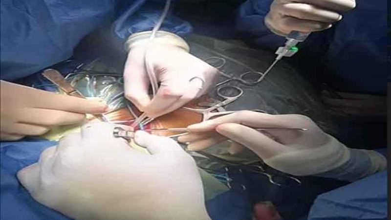 أسيوط الجامعي ينجح