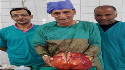استئصال ورم يزن 20 كيلو من بطن سيدة بالشرقية