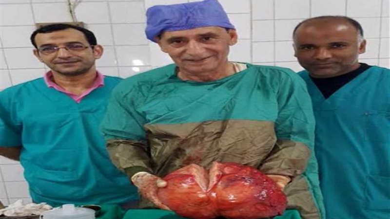 استئصال ورم يزن 20