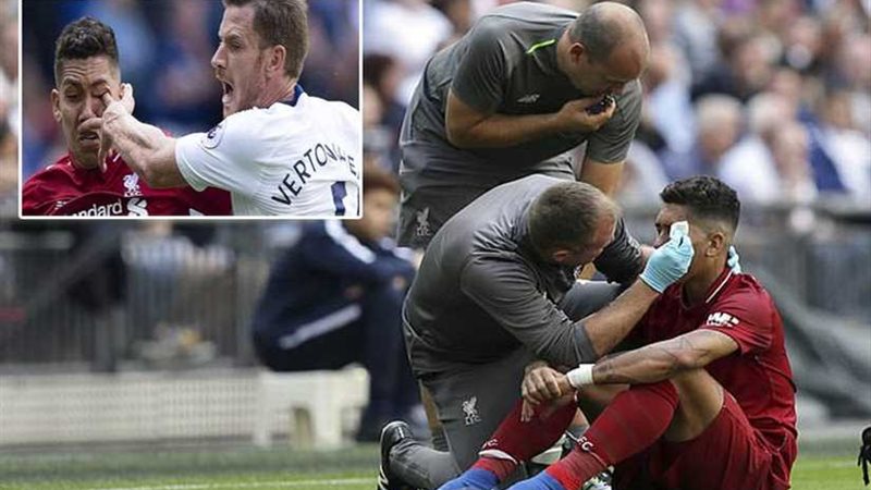 ليفربول: تقييم حالة