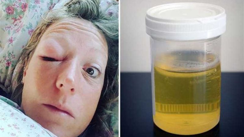 تشرب كأسين من البول