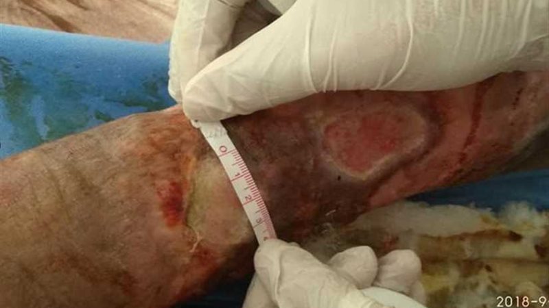 جامعة أسيوط تعالج