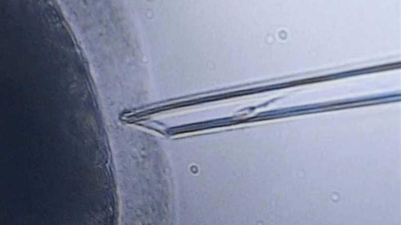 أول حالة حمل بدون