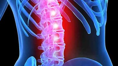 أسبابه غير معروفة ..مرض غامض ينتشر في أمريكا