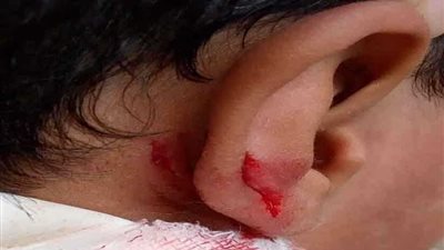 ”سندوتش“ وراء تعدي طالب الابتدائية علي أخر بشفرة حلاقة بـ” المنوفية“