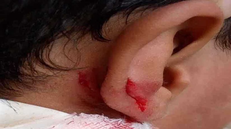 ”سندوتش“ وراء تعدي