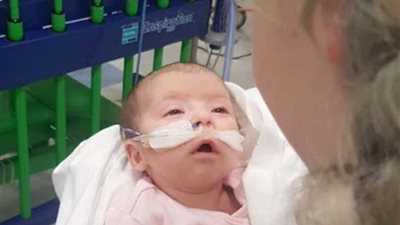 القبلة المميتة.. عندما يحمل الحنان فيروسات الموت