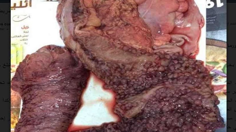 ناصر العام بشبرا