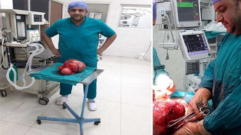 أورام طنطا يستأصل