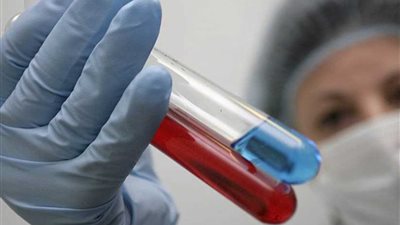 طفرة طبية... فريق بحثي فرنسي يكتشف علاجا لـ