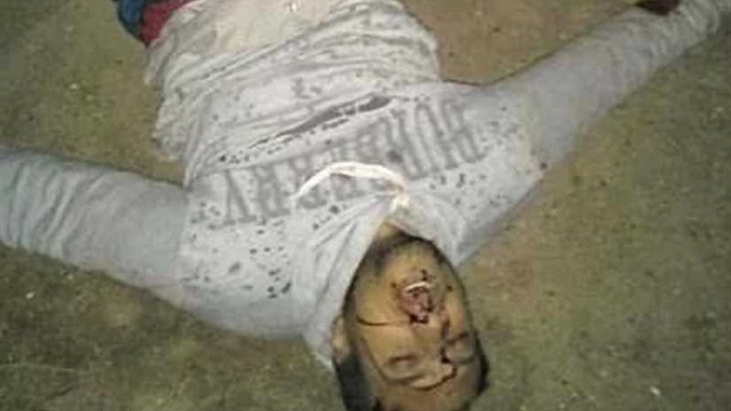 بالصور ..إصابة مواطنين