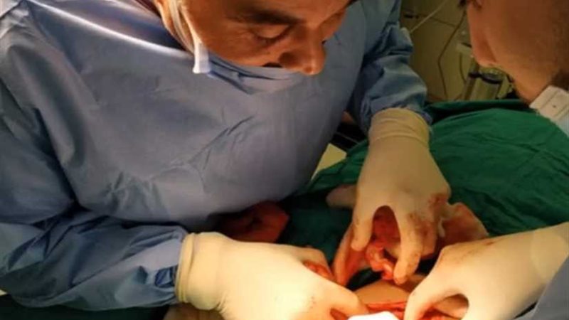 نجاح عمليات استئصال