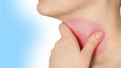 احتقان الحلق علامة لمرض خطير