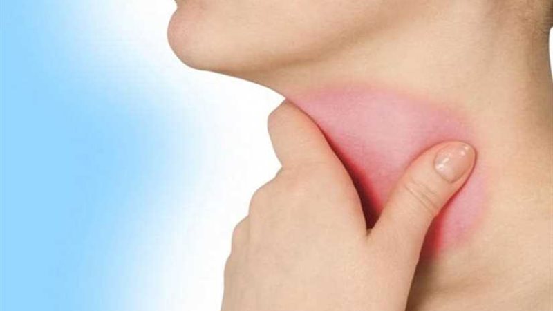 احتقان الحلق علامة