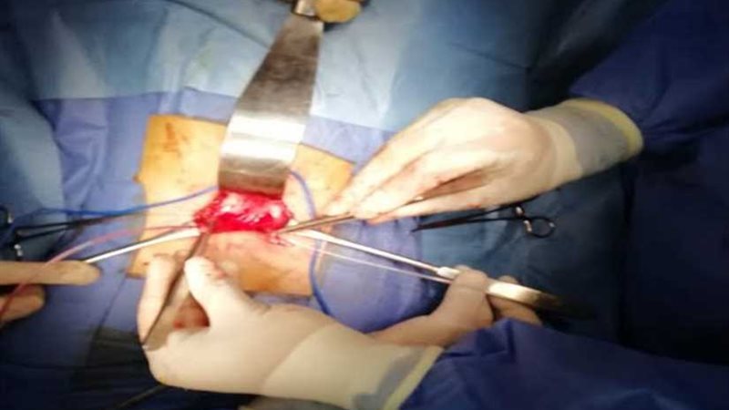 التأمين الصحي ببنها