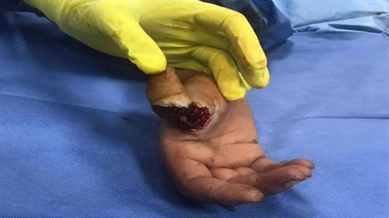 مستشفيات جامعة المنوفية