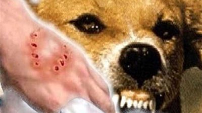 كلب ضال يعقر ٨ مواطنين بينهم طفل بالخانكة