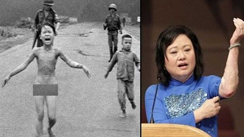 فتاة النابالم تفوز