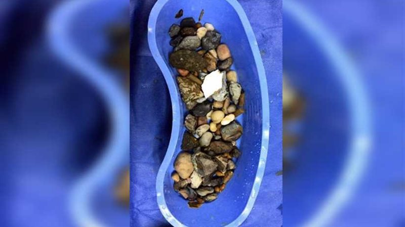 فريق طبي ينجح في