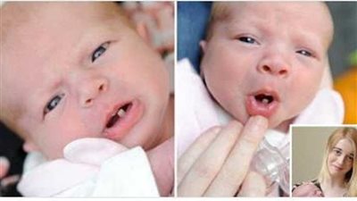 ولادة طفلة بـ 