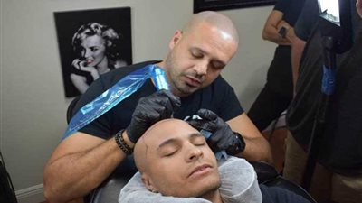 سيف صدقي.. حارب الصلع بالرسم في فروة الرأس