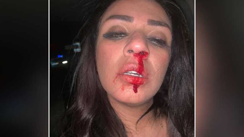 بالصور.. المطربة