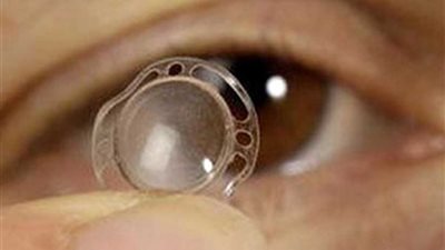 فريق طبي بجامعة عين شمس ينجح في زراعة أول قرنية صناعية بمصر