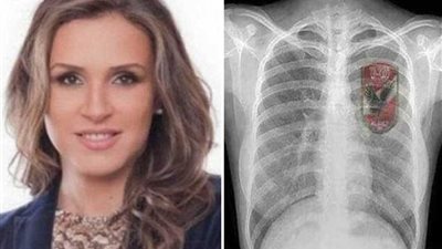 رانيا علواني قبل القمة 117 معاك يا أهلي