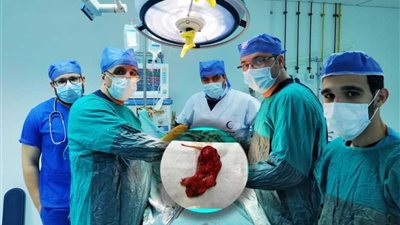 إجراء عملية جراحية لمريضة بخراج في الرئة في مستشفى العريش العام