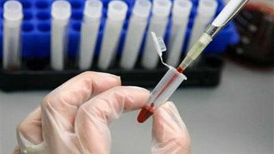 إصابة 1250 تلميذا أمريكيا بالإيدز والتهاب الكبد إثر 