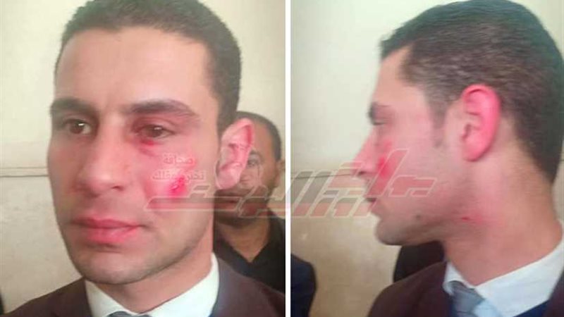 مواطن يضرب محاميًا