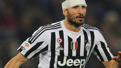 كيلليني قد يغيب عن يوفنتوس أمام أياكس في إياب ربع نهائي دوري الأبطال