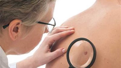 أعراض مبكرة لمختلف أنواع السرطان.. تعرف عليها