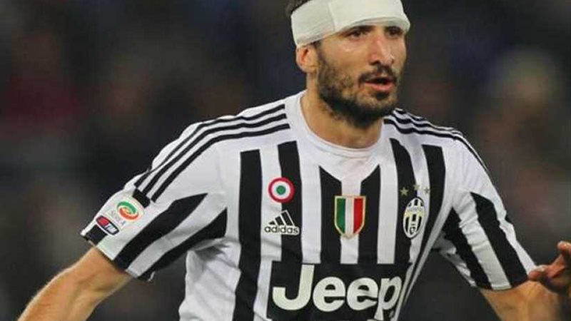 كيلليني قد يغيب عن