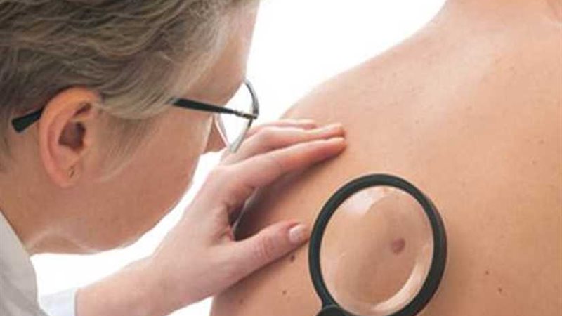 أعراض مبكرة لمختلف