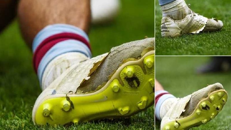 شاهد .. حذاء مهترئ